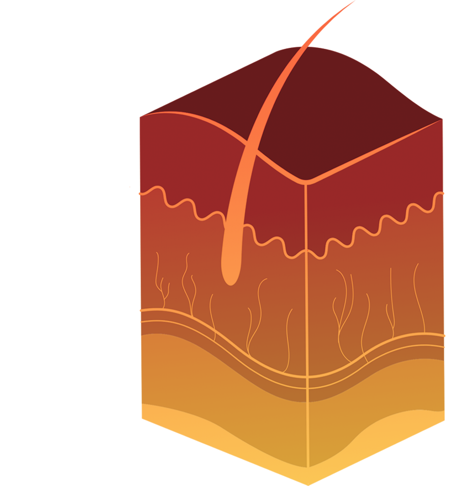 ANSI-HEAT_SkinGraphic